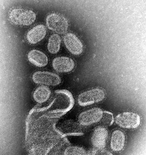 (사진 설명 : 독감 바이러스, 출처 위키피디아)